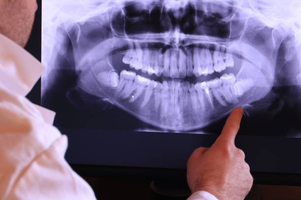 Best Emergency Tooth Extraction in Eastland, TX